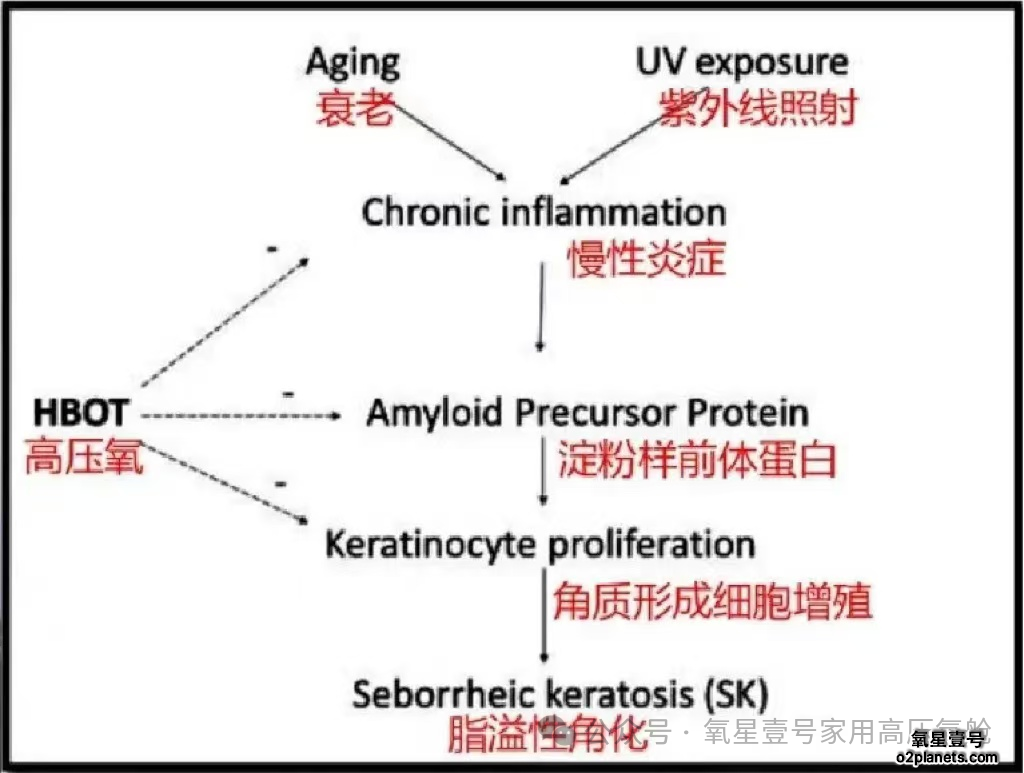 氧星壹号家用高压氧舱：连泰国选美冠军都pick的”状态管理“神器!