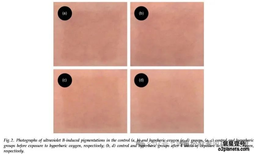 氧星壹号家用高压氧舱：连泰国选美冠军都pick的”状态管理“神器!