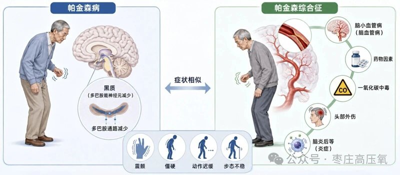 高压氧与帕金森综合征