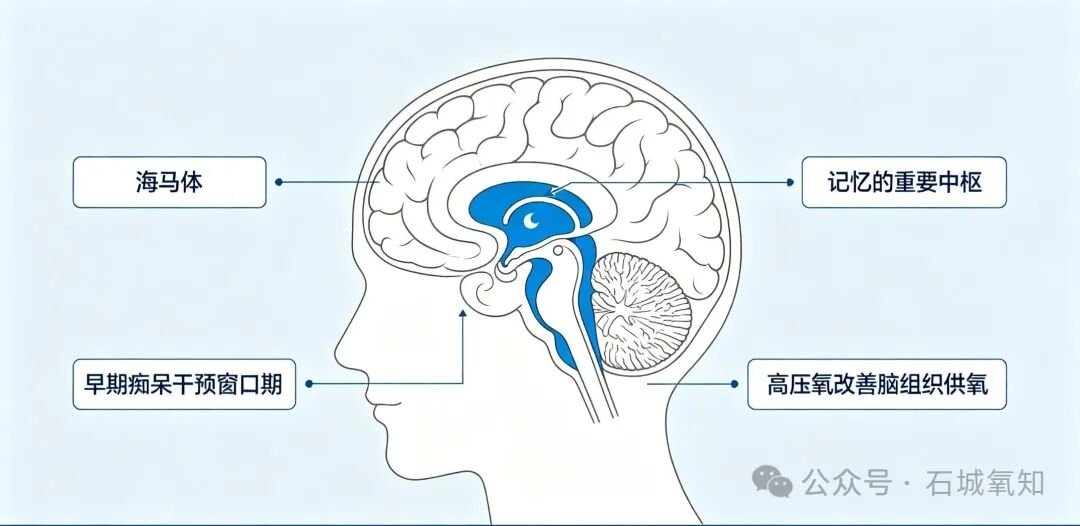 【健康科普】高压氧,为早期老年痴呆按下“减速刹车”
